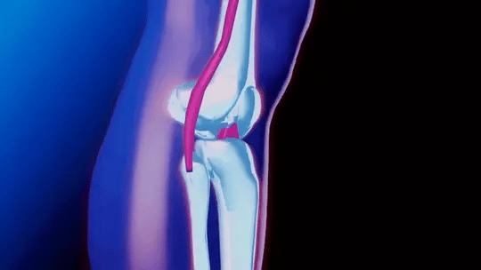 Artivo™ - Stable Knee Support For Daily Activity