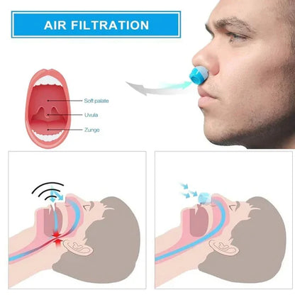 Somnix™ - Compact Nasal Micro-CPAP For Quieter Sleep