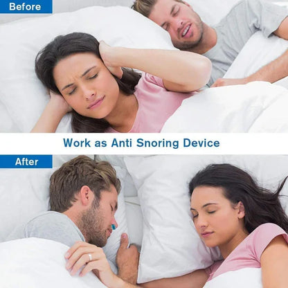 Somnix™ - Compact Nasal Micro-CPAP For Quieter Sleep