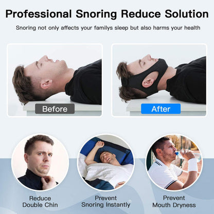 Somnix™ - Gentle Chin Support for Quieter Nights