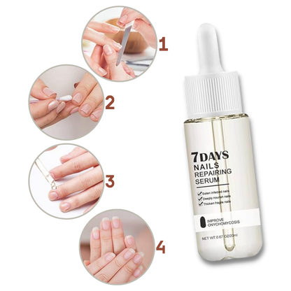 Kerena™ - Daily Nail Repair For Brittle, Splitting Nails