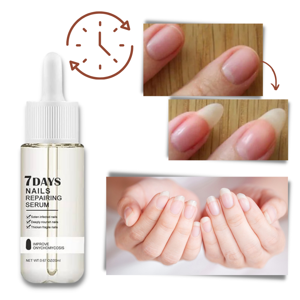 Kerena™ - Daily Nail Repair For Brittle, Splitting Nails