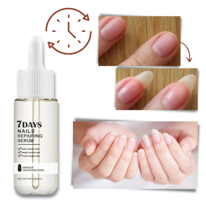 Kerena™ - Daily Nail Repair For Brittle, Splitting Nails
