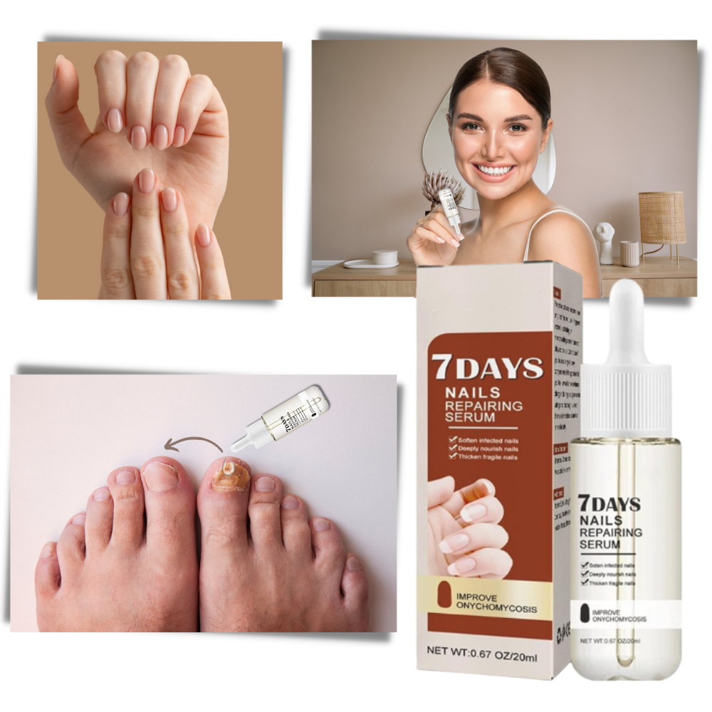 Kerena™ - Daily Nail Repair For Brittle, Splitting Nails
