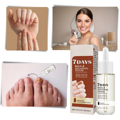 Kerena™ - Daily Nail Repair For Brittle, Splitting Nails