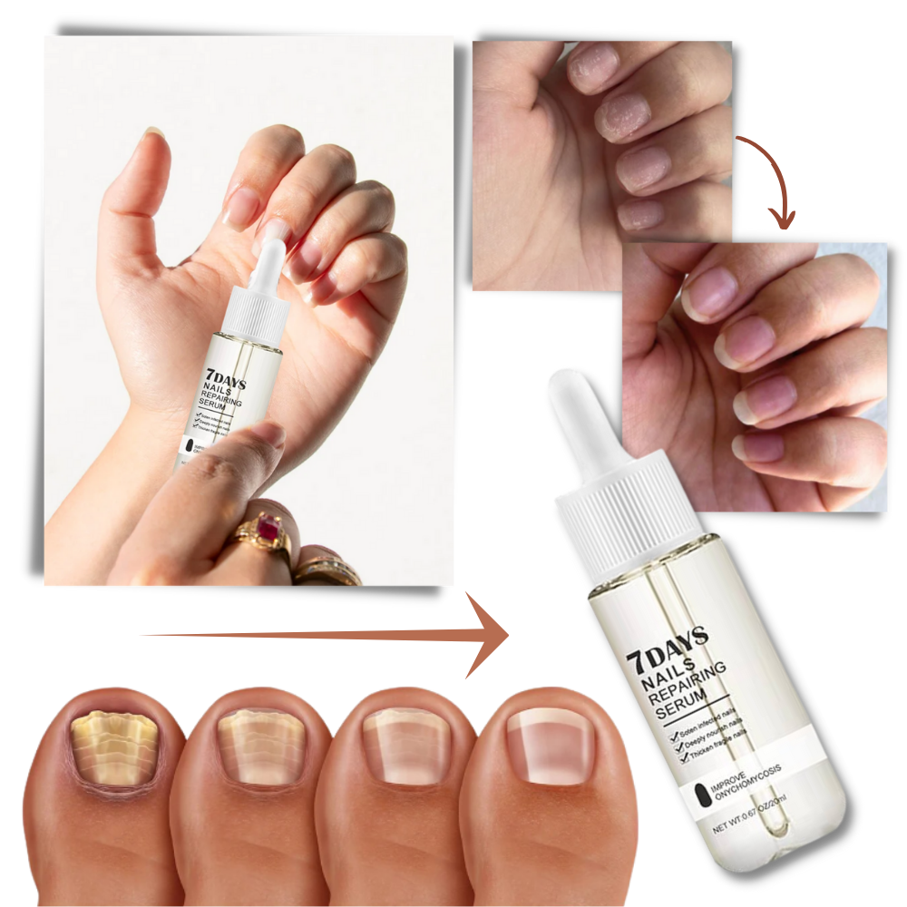 Kerena™ - Daily Nail Repair For Brittle, Splitting Nails