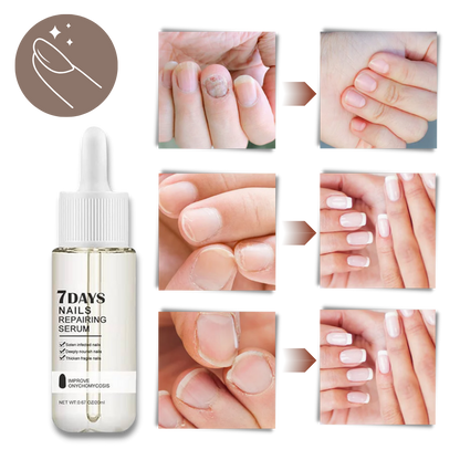 Kerena™ - Daily Nail Repair For Brittle, Splitting Nails