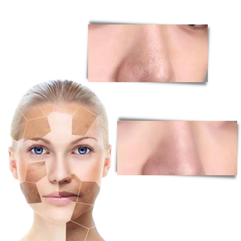 Verida™ - Deep-Cleaning Roll-On Mask for Clear Skin