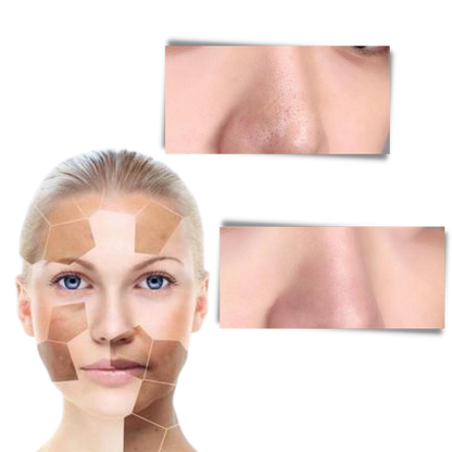 Verida™ - Deep-Cleaning Roll-On Mask for Clear Skin