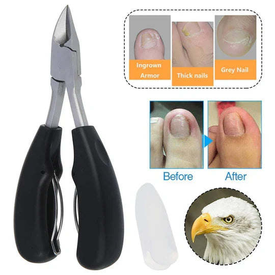 Vellor™ - Smooth, Effortless Trimming for Thick Nails