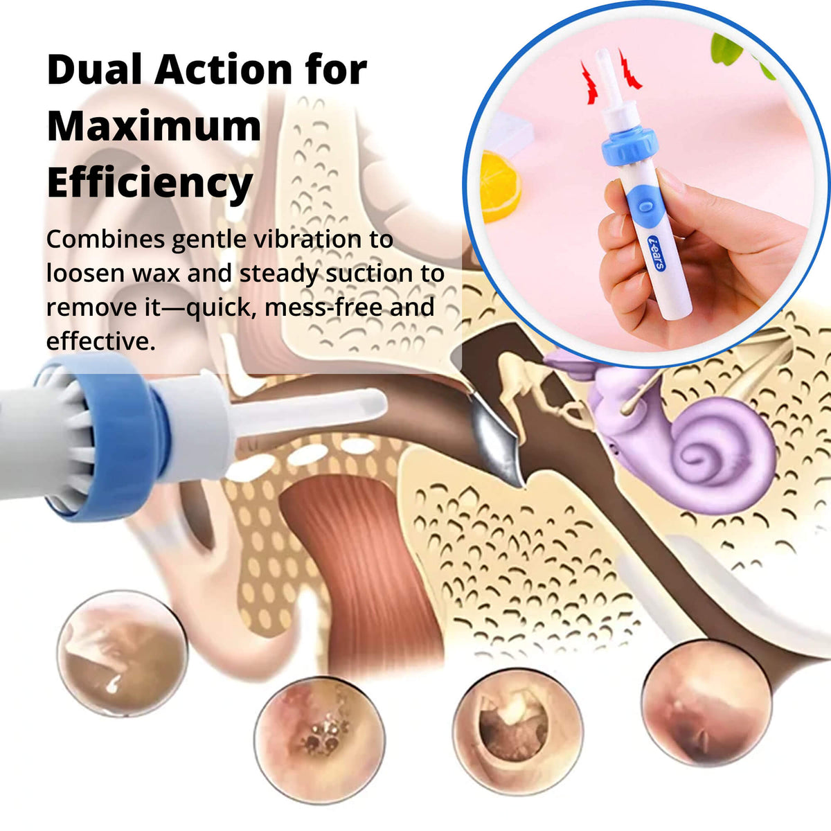 Aurix™ - Gentle Suction Ear Cleaning At Home