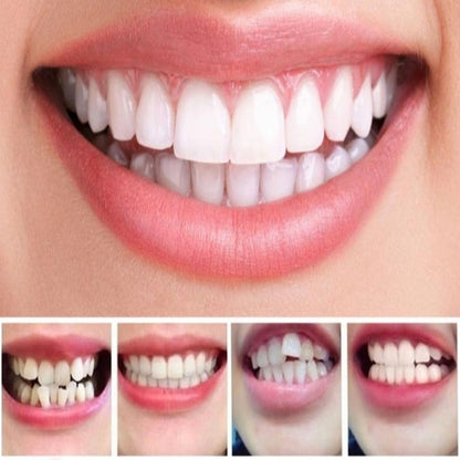 Aligna™ - Gentle Three-Step At-Home Teeth Guidance