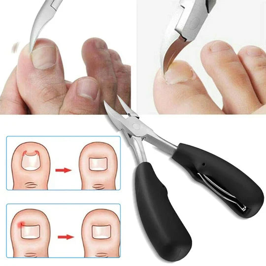 Vellor™ - Smooth, Effortless Trimming for Thick Nails