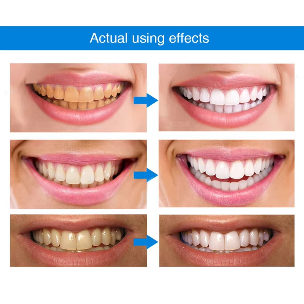 Lustra™ - Subtle Whitening For A Brighter Smile