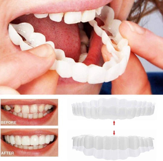Smilix™ - Temporary Cosmetic Cover For A Uniform Smile