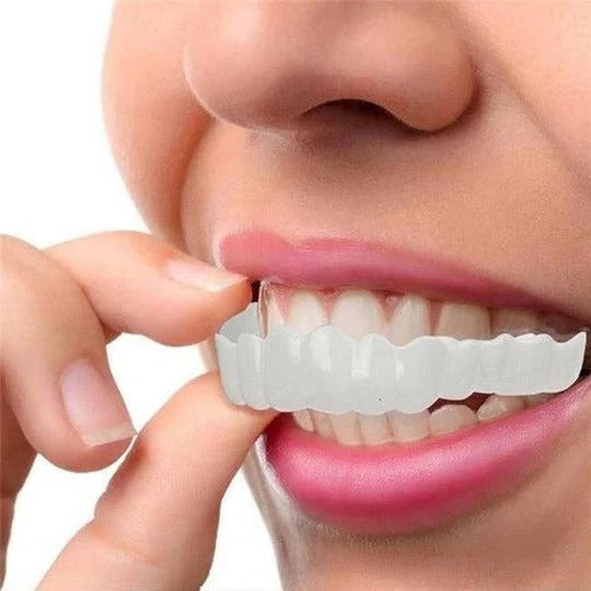 Smilix™ - Temporary Cosmetic Cover For A Uniform Smile