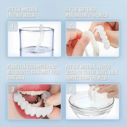 Smilix™ - Temporary Cosmetic Cover For A Uniform Smile