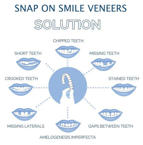 Smilix™ - Temporary Cosmetic Cover For A Uniform Smile
