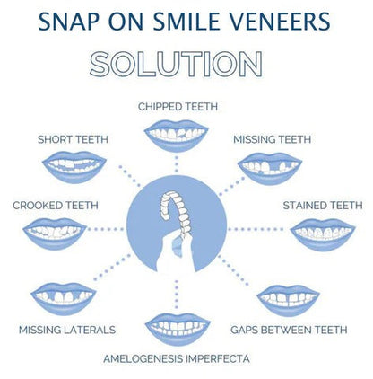 Smilix™ - Temporary Cosmetic Cover For A Uniform Smile