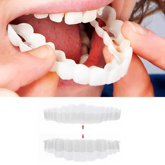 Smilix™ - Temporary Cosmetic Cover For A Uniform Smile