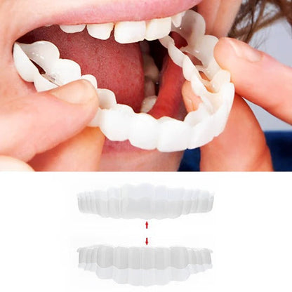 Smilix™ - Temporary Cosmetic Cover For A Uniform Smile