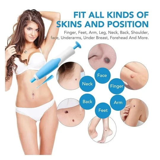 Cirra™ - Precise Placement for Small Raised Skin Areas
