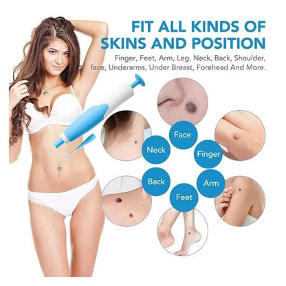 Cirra™ - Precise Placement for Small Raised Skin Areas