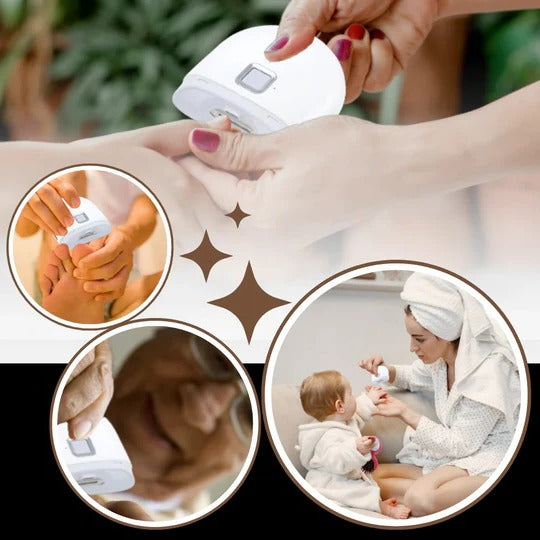 Trimora™ - Quiet, Precise Nail Grooming at Home