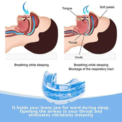 Somnex™ - Gentle Jaw Alignment for Quieter Sleep