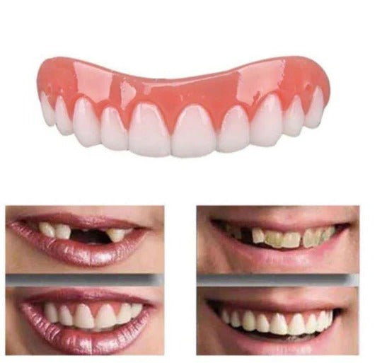 Smylin™ - Natural-Looking Temporary Smile Coverage