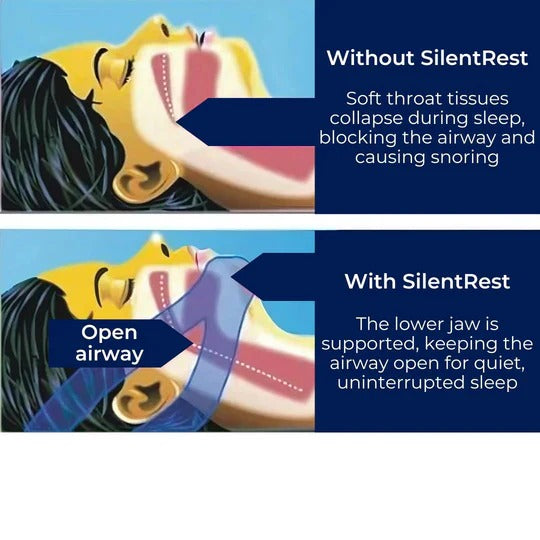 Noctiva™ - Gentle Overnight Jaw Support For Nasal Breathing