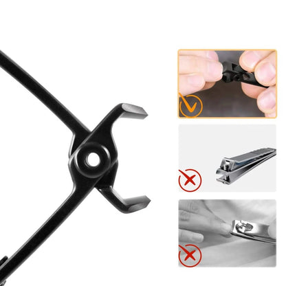Clipsis™ - For Smooth Trimming of Thick Toenails
