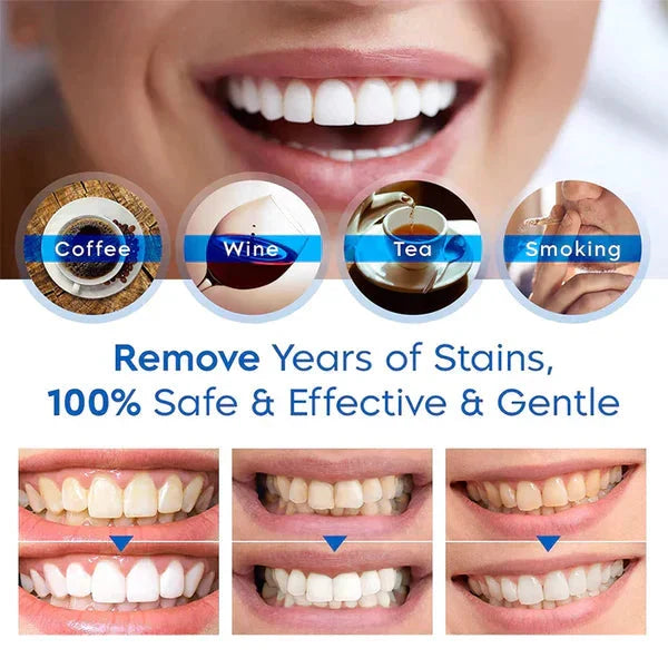 Lustra™ - Subtle Whitening For A Brighter Smile