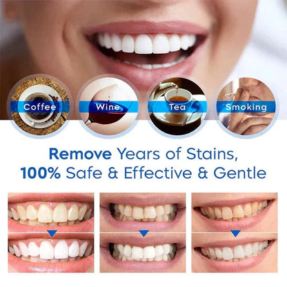 Lustra™ - Subtle Whitening For A Brighter Smile